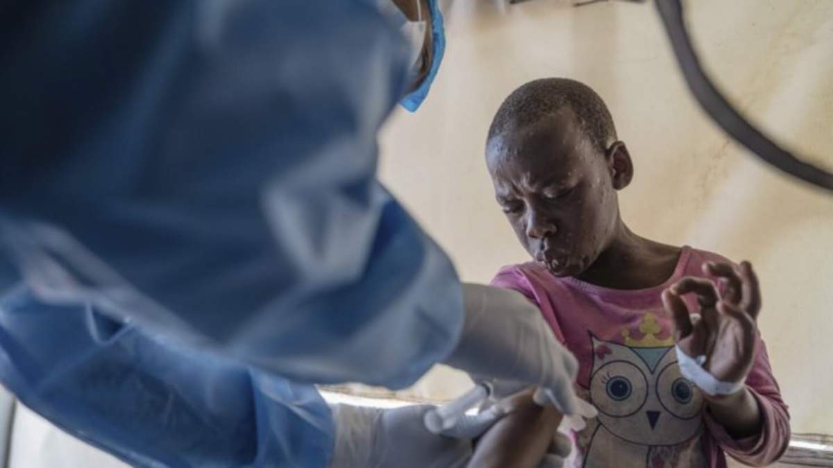 Un trabajador sanitario atiende a un paciente con viruela símica en un centro de tratamiento en Munigi, en el este de República Democrática de Congo, el 19 de agosto de 2024