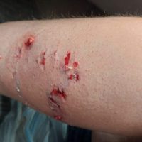 Turistas fueron atacadas por dos perros callejeros en Villa La Angostura