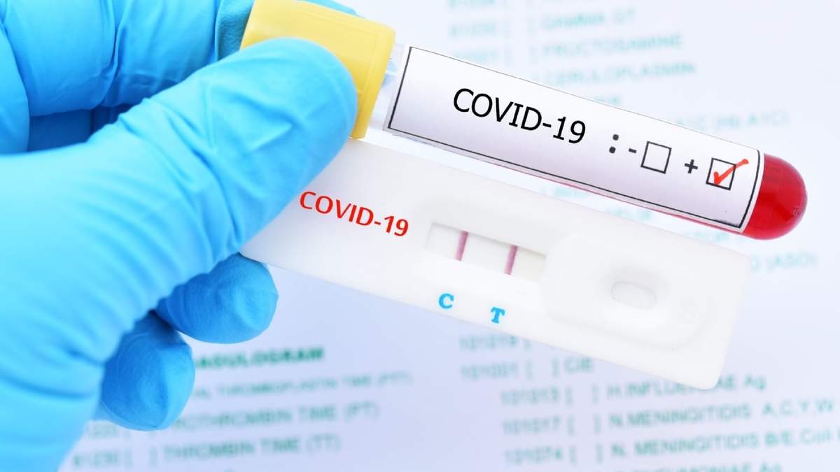 Testeos coronavirus. Fuente: (Twitter)
