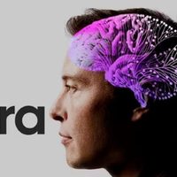 El chip de Neuralink que promete devolverle la visión a los ciegos