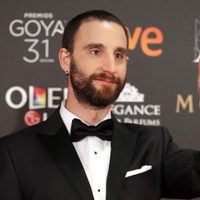 No termina todavía su calvario: Dani Rovira compartió su nuevo tratamiento tras la quimioterapia