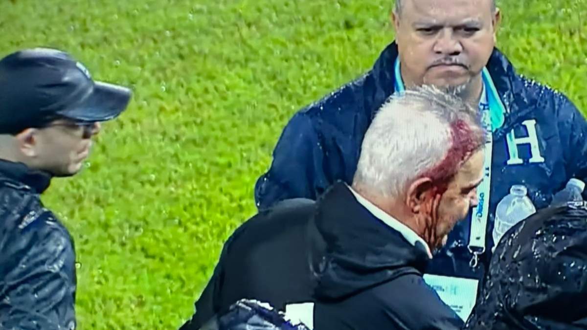Federación Mexicana de Futbol condena ataque a su entrenador Javier Aguirre