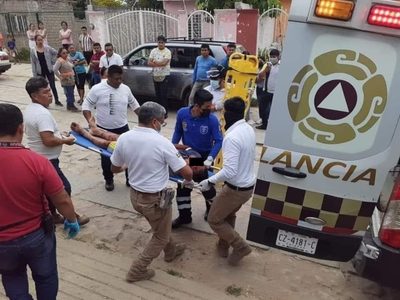 Pitbull casi le arranca un brazo a presunto ladrón; exigen no sacrificar al "héroe de Copoya