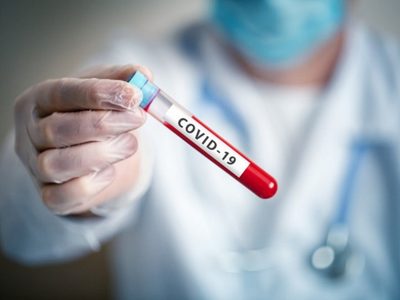 Zapala impactado con los 72 casos positivos de COVID 19 reportados en un solo día