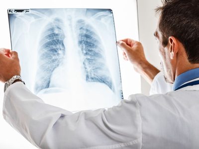 Día mundial contra el Cáncer: Según la OMS, al menos un tercio de todos los casos, pueden prevenirse