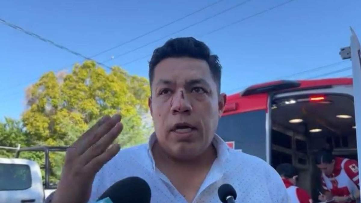 El periodista Jorge Heras, tras haber sido golpeado por dos sujetos en Mexicali, Baja California