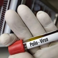 Alerta en Estados Unidos por el primer caso de poliomielitis en casi una década