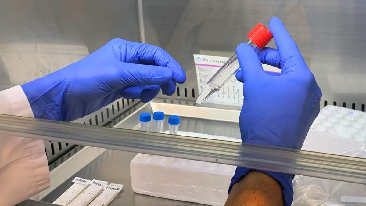 Muestras de coronavirus. Fuente: (Twitter)
