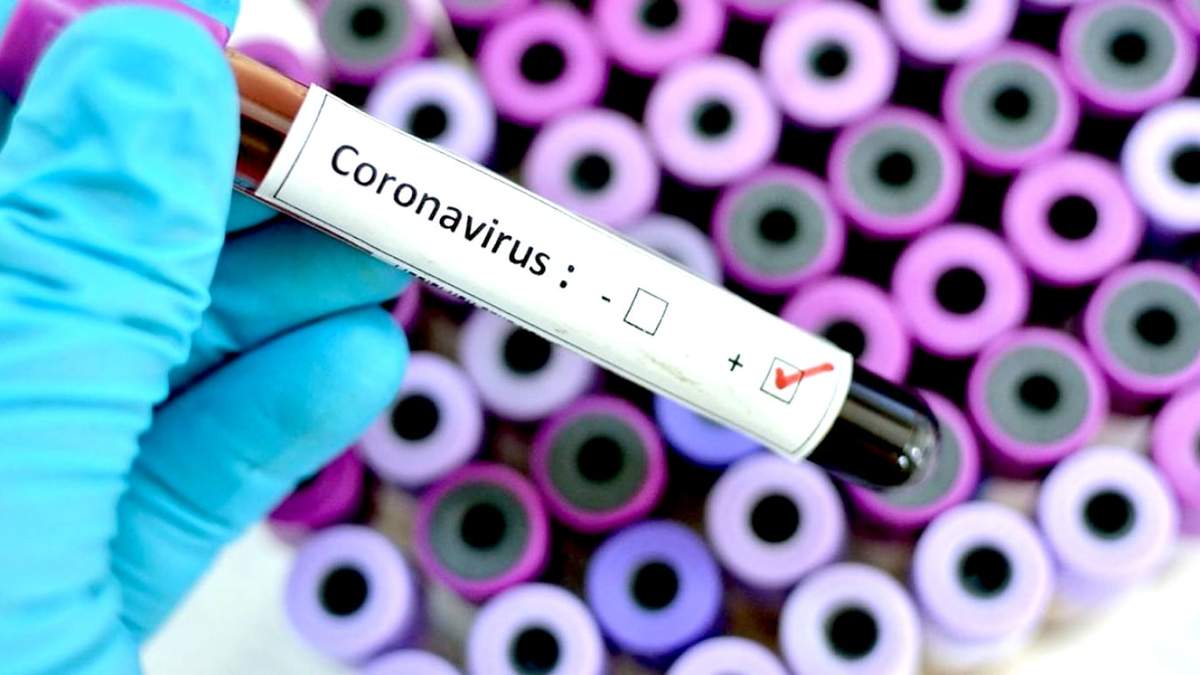 Análisis por coronavirus. Fuente: (Twitter)
