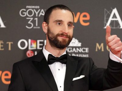 No termina todavía su calvario: Dani Rovira compartió su nuevo tratamiento tras la quimioterapia