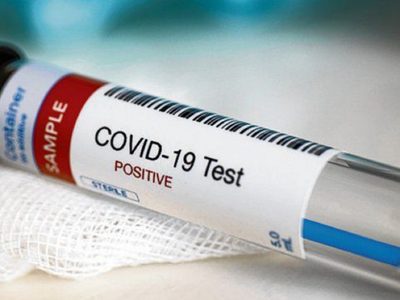 Zapala: jornada con alarmante incremento de casos positivos de coronavirus