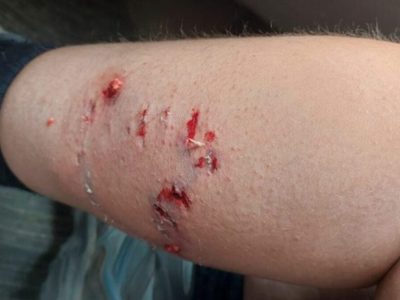 Turistas fueron atacadas por dos perros callejeros en Villa La Angostura