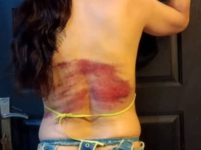 Mujer iraní es sometida a 74 latigazos por no cubrir su cabello en público