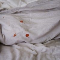 El truco para eliminar las manchas de sangre de tus sábanas y dejarlas como nuevas