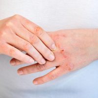 Con pocos ingredientes, la mezcla "mágica" para combatir la resequedad de tus manos este invierno
