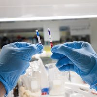 Argentina creó un test rápido para detectar anticuerpos de coronavirus en solo 10 minutos