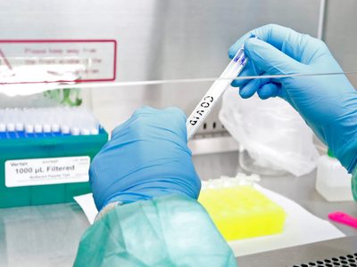 Laboratorio argentino comenzará a producir "ahora, y a riesgo", la vacuna contra el coronavirus