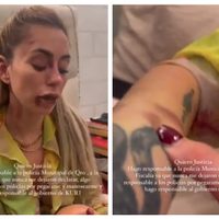 Mujer revela que la actriz Florencia Alducin la golpeó con el puño y la amenazó tras choque en Qro