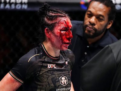 Irene Aldana sufre espeluznante corte en su rostro durante su pelea en la UFC (Video)