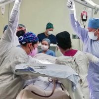 Trasplantan con éxito el hígado de un donador que dio positivo a covid-19