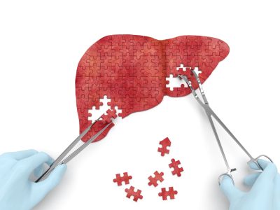 Indonesia confirmó la muerte de 3 niños por la misteriosa hepatitis: ya hay 228 casos en el mundo