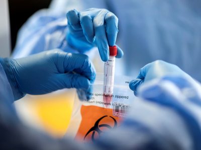El coronavirus está presente en todo Cipolletti