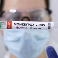 España logró obtener la secuencia completa del virus de la viruela del mono