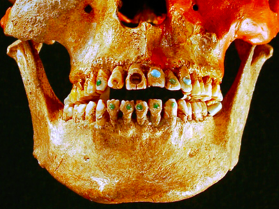 Revelaron por qué los mayas incrustaban piedras preciosas en sus dientes: no era solo por estética