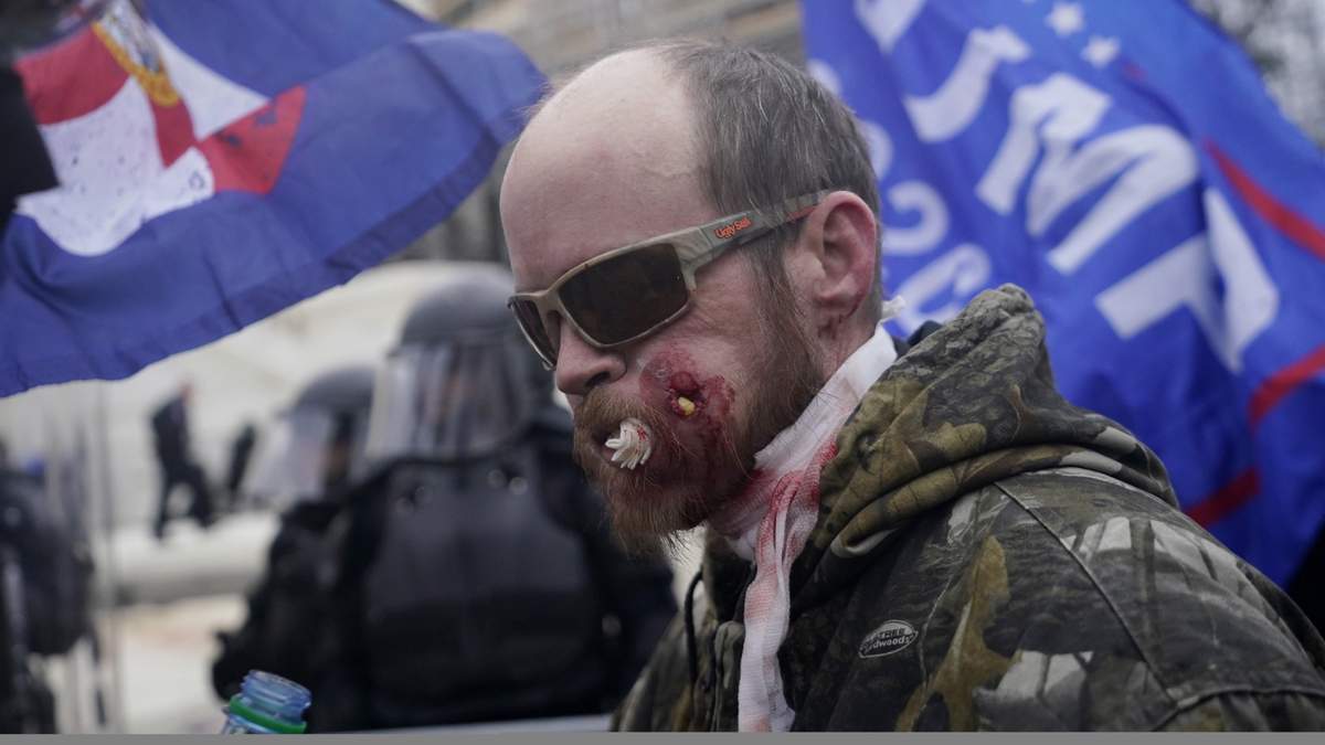 Un manifestante herido tras los enfrentamientos frente al Congreso de Estados Unidos