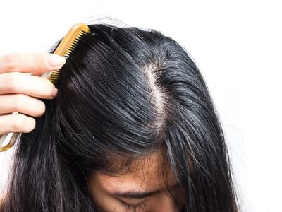 No compres más shampoo: el ingrediente de cocina que mantiene tu pelo limpio y con volumen