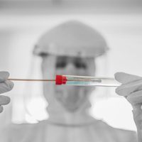 Los casos de coronavirus a nivel mundial vuelven a bajar por segunda semana consecutiva