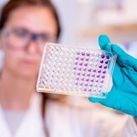Vacuna de Oxford y AstraZeneca produce inmunidad en adultos jóvenes y ancianos: The Lancet