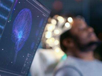 Estudio encuentra relación bidireccional entre enfermedad inflamatoria intestinal y la depresión