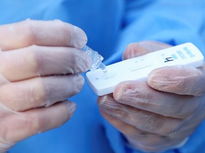 Qué hará Neuquén ante la venta libre de test rápidos de coronavirus