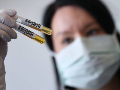 Neuquén Capital administrará plasma a pacientes con cuadros de coronavirus leves
