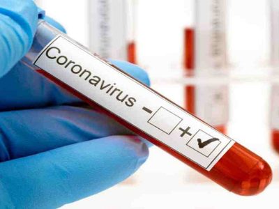 Zapala, muy cerca de alcanzar los 400 casos activos de coronavirus