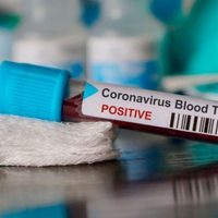 Neuquén: 8 nuevos casos de coronavirus