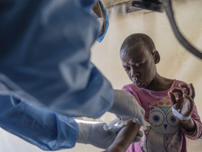 Comienza vacunación contra viruela símica en el Congo para contener emergencia global