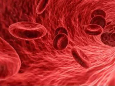 Las personas con leucemia pueden no estar protegidas de forma óptima tras vacuna contra el covid-19