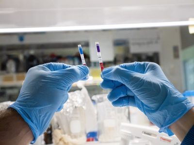 Argentina creó un test rápido para detectar anticuerpos de coronavirus en solo 10 minutos