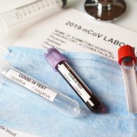 Coronavirus: Neuquén implementó tres nuevos métodos de testeo
