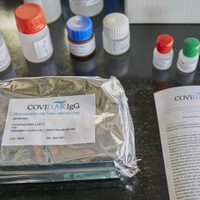 Coronavirus: el test serológico argentino superó una nueva marca de producción