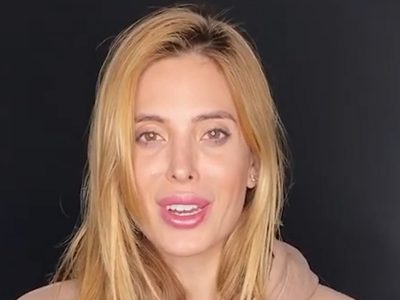 Impresiona un poco: Jesica Cirio se sacó el vendaje y mostró su mano tras el incidente