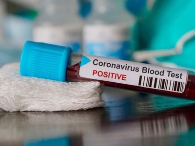 ¡Continúan los contagios!: hay 3 nuevos casos en Río Negro
