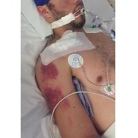 Alcalde de León ofrece apoyar en investigaciones sobre presunta golpiza propinada por policías a un joven