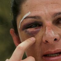 Reaparece Guevara tras golpiza; 'quiero que la gente me vea”, dice