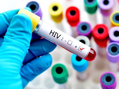 ¡Histórico! Científicos argentinos aplicaron la primera dosis de la vacuna preventiva contra el VIH