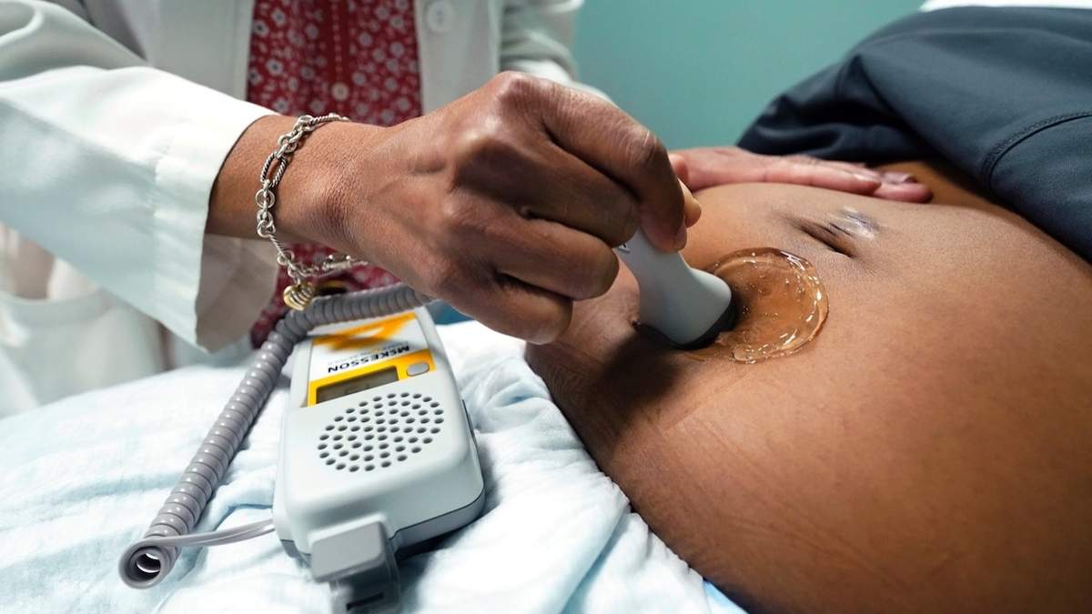 Ultrasonido a una embarazada