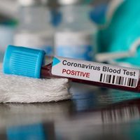 Coronavirus en Río Negro: qué dice el último parte de Salud