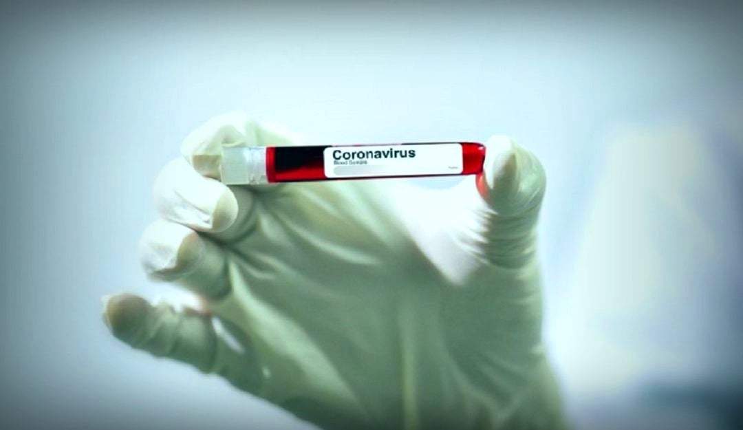 En Neuquén no hay nuevos casos de coronavirus.